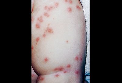 средней кишки