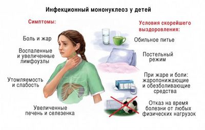 мононуклеоз мононуклеоз