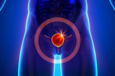 мочевого пузыря