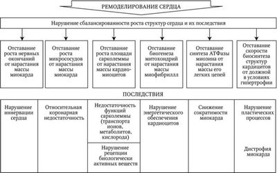 стенокардия