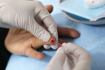 выражением CCR5