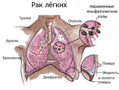 лучевой