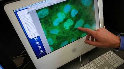 Клиники стволовых клеток в США пережили бум, а FDA приостановило репрессии